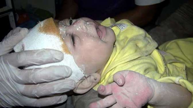 Suriyede 1 aylık bebek enkazdan sağ çıkarıldı