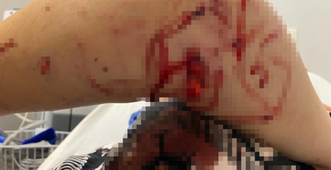 Kartepe’de Bahçeye Abdest Almaya Çıkan Kadına Köpek Saldırdı