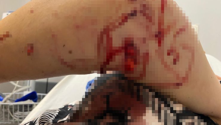 Kartepe’de Bahçeye Abdest Almaya Çıkan Kadına Köpek Saldırdı